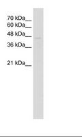 TRIM59 Antibody - Jurkat Cell Lysate.  This image was taken for the unconjugated form of this product. Other forms have not been tested.