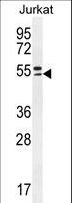 TRIM59 Antibody - TRIM59 Antibody western blot of Jurkat cell line lysates (35 ug/lane). The TRIM59 antibody detected the TRIM59 protein (arrow).