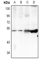 TRIM59 Antibody - Western blot analysis of TRIM59 expression in Jurkat (A), HEK293T (B), rat brain (C), mouse brain (D) whole cell lysates.