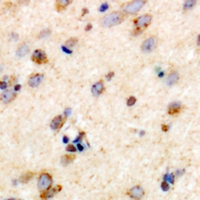 TRIM59 Antibody - Immunohistochemical analysis of TRIM59 staining in human brain formalin fixed paraffin embedded tissue section. The section was pre-treated using heat mediated antigen retrieval with sodium citrate buffer (pH 6.0). The section was then incubated with the antibody at room temperature and detected using an HRP conjugated compact polymer system. DAB was used as the chromogen. The section was then counterstained with haematoxylin and mounted with DPX.