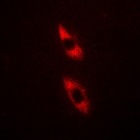 TRIM59 Antibody - Immunofluorescent analysis of TRIM59 staining in HeLa cells. Formalin-fixed cells were permeabilized with 0.1% Triton X-100 in TBS for 5-10 minutes and blocked with 3% BSA-PBS for 30 minutes at room temperature. Cells were probed with the primary antibody in 3% BSA-PBS and incubated overnight at 4 °C in a hidified chamber. Cells were washed with PBST and incubated with Alexa Fluor 647-conjugated secondary antibody (red) in PBS at room temperature in the dark.