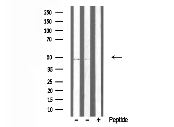 TRIM59 Antibody - Western blot analysis of extracts of various samples using TRIM59 antibody.