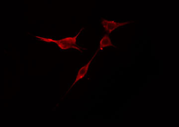 TRIM59 Antibody - Staining NIH-3T3 cells by IF/ICC. The samples were fixed with PFA and permeabilized in 0.1% Triton X-100, then blocked in 10% serum for 45 min at 25°C. The primary antibody was diluted at 1:200 and incubated with the sample for 1 hour at 37°C. An Alexa Fluor 594 conjugated goat anti-rabbit IgG (H+L) antibody, diluted at 1/600, was used as secondary antibody.