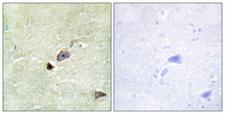 TRIM59 Antibody - Peptide - + Immunohistochemistry analysis of paraffin-embedded human brain tissue using TRIM59 antibody.