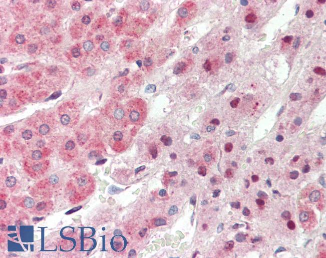 TRIM6 Antibody - Anti-TRIM6 antibody IHC staining of human adrenal. Immunohistochemistry of formalin-fixed, paraffin-embedded tissue after heat-induced antigen retrieval. Antibody concentration 10 ug/ml.  This image was taken for the unconjugated form of this product. Other forms have not been tested.