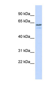 TRIM6 Antibody - TRIM6 / RNF89 antibody Western blot of 293T cell lysate.  This image was taken for the unconjugated form of this product. Other forms have not been tested.