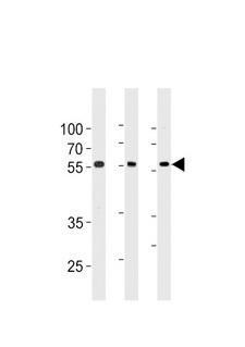 TRIM6 Antibody - TRIM6 Antibody western blot of 293,A549,Ramos cell line lysates (35 ug/lane). The TRIM6 antibody detected the TRIM6 protein (arrow).