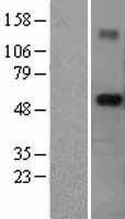 TRIM6 Protein - Western validation with an anti-DDK antibody * L: Control HEK293 lysate R: Over-expression lysate