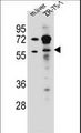 TRIM62 Antibody - TRIM62 Antibody western blot of mouse liver tissue and ZR-75-1 cell line lysates (35 ug/lane). The TRIM62 antibody detected the TRIM62 protein (arrow).