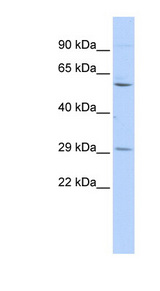 TRIM62 Antibody - TRIM62 antibody Western blot of 293T cell lysate. This image was taken for the unconjugated form of this product. Other forms have not been tested.