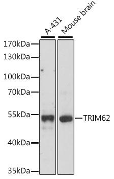 TRIM62 Antibody - Western blot analysis of extracts of various cell lines using TRIM62 Polyclonal Antibody at dilution of 1:1000.