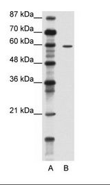 TRIM62 Antibody - A: Marker, B: Jurkat Cell Lysate.  This image was taken for the unconjugated form of this product. Other forms have not been tested.