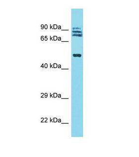 TRIM64 Antibody - Western blot of Human Fetal Lung. TRIM64 antibody dilution 1.0 ug/ml.  This image was taken for the unconjugated form of this product. Other forms have not been tested.