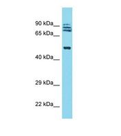 TRIM64 Antibody - Western blot of Human Fetal Lung. TRIM64 antibody dilution 1.0 ug/ml.  This image was taken for the unconjugated form of this product. Other forms have not been tested.