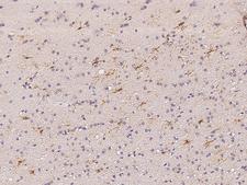 TRIM64C Antibody - Immunochemical staining of human TRIM64C in human brain with rabbit polyclonal antibody at 1:100 dilution, formalin-fixed paraffin embedded sections.