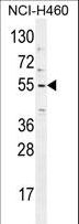 TRIM65 Antibody - TRIM65 Antibody western blot of NCI-H460 cell line lysates (35 ug/lane). The TRIM65 antibody detected the TRIM65 protein (arrow).