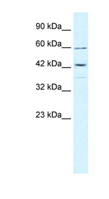 TRIM68 Antibody - TRIM68 antibody Western blot of DU145 cell lysate. This image was taken for the unconjugated form of this product. Other forms have not been tested.