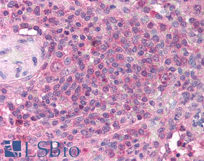 TRIM68 Antibody - Human Spleen (formalin-fixed, paraffin-embedded) stained with TRIM68 antibody LS-B1110 at 5 ug/ml followed by biotinylated goat anti-rabbit IgG secondary antibody, alkaline phosphatase-streptavidin and chromogen.  This image was taken for the unconjugated form of this product. Other forms have not been tested.