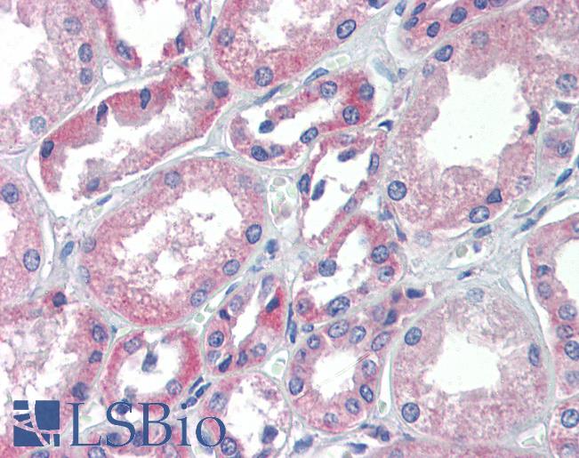 TRIM68 Antibody - Anti-TRIM68 antibody IHC of human kidney. Immunohistochemistry of formalin-fixed, paraffin-embedded tissue after heat-induced antigen retrieval. Antibody concentration 5 ug/ml.  This image was taken for the unconjugated form of this product. Other forms have not been tested.