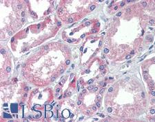 TRIM68 Antibody - Anti-TRIM68 antibody IHC of human kidney. Immunohistochemistry of formalin-fixed, paraffin-embedded tissue after heat-induced antigen retrieval. Antibody concentration 5 ug/ml.  This image was taken for the unconjugated form of this product. Other forms have not been tested.