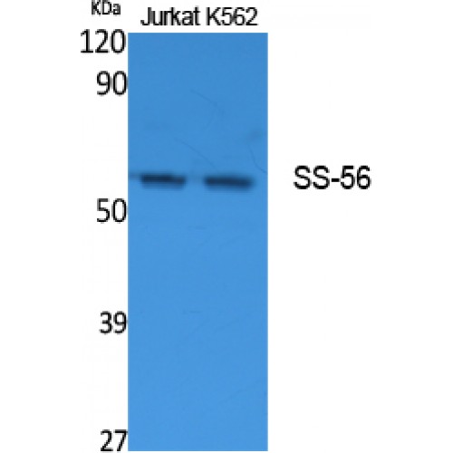 TRIM68 Antibody - Western blot of SS-56 antibody