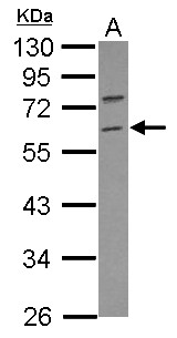 TRIM69 / Trif Antibody - Sample (30 ug of whole cell lysate) A: IMR32 10% SDS PAGE TRIM69 / RNF36 antibody diluted at 1:500