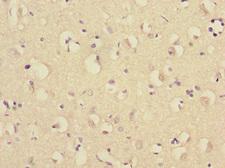TRIM69 / Trif Antibody - Immunohistochemistry of paraffin-embedded human brain at dilution 1:100