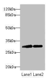 TRIM69 / Trif Antibody - Western blot All Lanes: TRIM69 antibody at 2.24ug/ml Lane 1: Mouse kidney tissue Lane 2: Mouse brain tissue Secondary Goat polyclonal to Rabbit IgG at 1/10000 dilution Predicted band size: 58,40,35,33 kDa Observed band size: 57 kDa,32 kDa