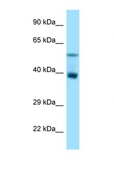 TRIM7 Antibody - TRIM7 antibody Western blot of Rat Liver lysate. Antibody concentration 1 ug/ml.  This image was taken for the unconjugated form of this product. Other forms have not been tested.