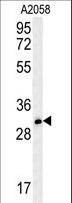 TRIM73 Antibody - TRI73 Antibody western blot of A2058 cell line lysates (35 ug/lane). The TRI73 antibody detected the TRI73 protein (arrow).