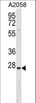 TRIM74 Antibody - TRIM74 Antibody western blot of A2058 cell line lysates (35 ug/lane). The antibody detected the protein (arrow).