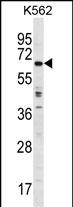 TRIM75P Antibody - TRIM75 Antibody (Center) western blot analysis in K562 cell line lysates (35ug/lane).This demonstrates the TRIM75 antibody detected the TRIM75 protein (arrow).