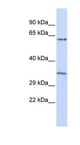 TRIM8 / GERP Antibody - TRIM8 / GERP antibody Western blot of Placenta lysate. This image was taken for the unconjugated form of this product. Other forms have not been tested.