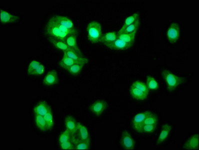 TRIM8 / GERP Antibody - Immunofluorescence staining of HepG2 cells at a dilution of 1:133, counter-stained with DAPI. The cells were fixed in 4% formaldehyde, permeabilized using 0.2% Triton X-100 and blocked in 10% normal Goat Serum. The cells were then incubated with the antibody overnight at 4 °C.The secondary antibody was Alexa Fluor 488-congugated AffiniPure Goat Anti-Rabbit IgG (H+L) .