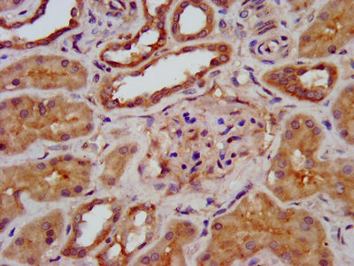 TRIM8 / GERP Antibody - IHC image of TRIM8 Antibody diluted at 1:400 and staining in paraffin-embedded human kidney tissue performed on a Leica BondTM system. After dewaxing and hydration, antigen retrieval was mediated by high pressure in a citrate buffer (pH 6.0). Section was blocked with 10% normal goat serum 30min at RT. Then primary antibody (1% BSA) was incubated at 4°C overnight. The primary is detected by a biotinylated secondary antibody and visualized using an HRP conjugated SP system.