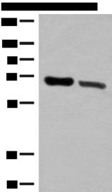 TRIM8 / GERP Antibody - Western blot analysis of Human placenta tissue and Human fetal brain tissue lysates  using TRIM8 Polyclonal Antibody at dilution of 1:500