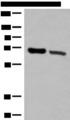 TRIM8 / GERP Antibody - Western blot analysis of Human placenta tissue and Human fetal brain tissue lysates  using TRIM8 Polyclonal Antibody at dilution of 1:500
