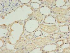 Trimethylguanosine Synthase 1 Antibody - Immunohistochemistry of paraffin-embedded human kidney using antibody at 1:100 dilution.  This image was taken for the unconjugated form of this product. Other forms have not been tested.