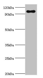 Trimethylguanosine Synthase 1 Antibody - Western blot All lanes: TGS1 antibody at 10µg/ml + Mouse skeletal muscle tissue Secondary Goat polyclonal to rabbit IgG at 1/10000 dilution Predicted band size: 97 kDa Observed band size: 97 kDa