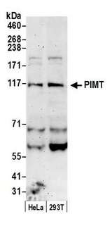 Trimethylguanosine Synthase 1 Antibody - Detection of human PIMT by western blot. Samples: Whole cell lysate (50 µg) from HeLa and 293T cells prepared using NETN lysis buffer. Antibody: Affinity purified rabbit anti-PIMT antibody used for WB at 0.4 µg/ml. Detection: Chemiluminescence with an exposure time of 3 minutes.