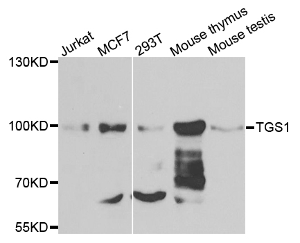 Trimethylguanosine Synthase 1 Antibody - Western blot analysis of extracts of various cells.