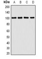 Trimethylguanosine Synthase 1 Antibody - Western blot analysis of PIMT expression in Jurkat (A); MCF7 (B); mouse thymus (C); mouse testis (D) whole cell lysates.