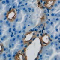 Trimethylguanosine Synthase 1 Antibody - Immunohistochemical analysis of PIMT staining in human kidney formalin fixed paraffin embedded tissue section. The section was pre-treated using heat mediated antigen retrieval with sodium citrate buffer (pH 6.0). The section was then incubated with the antibody at room temperature and detected using an HRP conjugated compact polymer system. DAB was used as the chromogen. The section was then counterstained with hematoxylin and mounted with DPX.