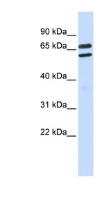 TRIML1 Antibody - TRIML1 antibody Western blot of Placenta lysate. This image was taken for the unconjugated form of this product. Other forms have not been tested.