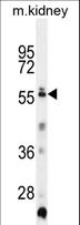 TRIML1 Antibody - TRIML1 Antibody western blot of mouse kidney tissue lysates (35 ug/lane). The TRIML1 antibody detected the TRIML1 protein (arrow).