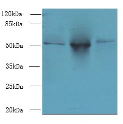 TRIML1 Antibody - Western blot. All lanes: TRIML1 antibody at 3 ug/ml. Lane 1: Mouse kidney tissue. Lane 2: Human placenta tissue. Lane 3: A431 whole cell lysate. Secondary antibody: Goat polyclonal to Rabbit IgG at 1:10000 dilution. Predicted band size: 53 kDa. Observed band size: 53 kDa.