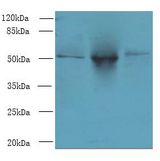 TRIML1 Antibody - Western blot. All lanes: TRIML1 antibody at 3 ug/ml. Lane 1: Mouse kidney tissue. Lane 2: Human placenta tissue. Lane 3: A431 whole cell lysate. Secondary antibody: Goat polyclonal to Rabbit IgG at 1:10000 dilution. Predicted band size: 53 kDa. Observed band size: 53 kDa.