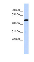 TRIML2 Antibody - TRIML2 antibody Western blot of Placenta lysate. This image was taken for the unconjugated form of this product. Other forms have not been tested.