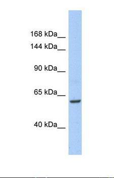 TRIO Antibody - Western blot of Human 721_B. TRIO antibody dilution 1.0 ug/ml.  This image was taken for the unconjugated form of this product. Other forms have not been tested.