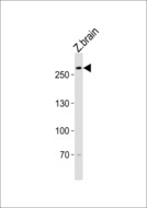 TRIO Antibody - Western blot of lysate from zebra fish brain tissue lysate with (DANRE) trio Antibody. Antibody was diluted at 1:1000. A goat anti-rabbit IgG H&L (HRP) at 1:5000 dilution was used as the secondary antibody. Lysate at 35 ug.